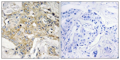Anti-TM4SF1 antibody used in IHC (Paraffin sections) (IHC-P). GTX87337