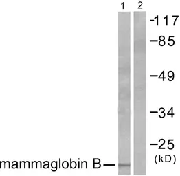 Anti-Mammaglobin B antibody used in Western Blot (WB). GTX87343