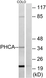 Anti-ACER3 antibody used in Western Blot (WB). GTX87351