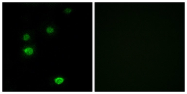 Anti-POLR3E antibody used in Immunocytochemistry/ Immunofluorescence (ICC/IF). GTX87366