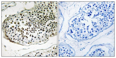 Anti-UBQLN3 antibody used in IHC (Paraffin sections) (IHC-P). GTX87400