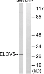 Anti-ELOVL5 antibody used in Western Blot (WB). GTX87413