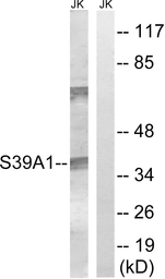 Anti-ZIP1 antibody used in Western Blot (WB). GTX87436