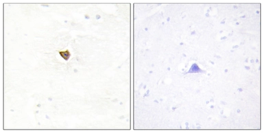 Anti-JAKMIP2 antibody used in IHC (Paraffin sections) (IHC-P). GTX87490