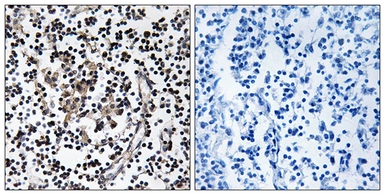 Anti-SLC30A4 antibody used in IHC (Paraffin sections) (IHC-P). GTX87502