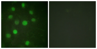 Anti-Histone H1 antibody used in Immunocytochemistry/ Immunofluorescence (ICC/IF). GTX87506