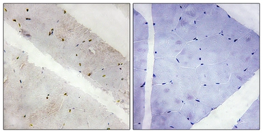 Anti-LATS2 antibody used in IHC (Paraffin sections) (IHC-P). GTX87529
