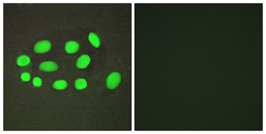 Anti-SPZ1 antibody used in Immunocytochemistry/ Immunofluorescence (ICC/IF). GTX87570
