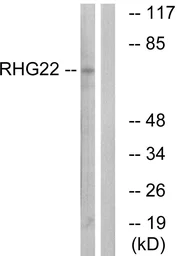 Anti-ARHGAP22 antibody used in Western Blot (WB). GTX87597