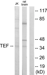 Anti-TEF antibody used in Western Blot (WB). GTX87608