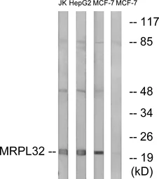 Anti-MRPL32 antibody used in Western Blot (WB). GTX87619