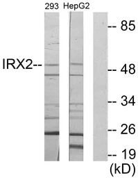 Anti-IRX2 antibody used in Western Blot (WB). GTX87634