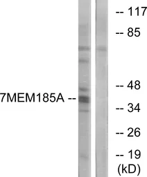 Anti-TMEM185A antibody used in Western Blot (WB). GTX87650