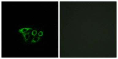 Anti-ATP5L2 antibody used in Immunocytochemistry/ Immunofluorescence (ICC/IF). GTX87665