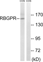 Anti-RAB3GAP2 antibody used in Western Blot (WB). GTX87680