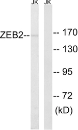Anti-ZEB2 antibody used in Western Blot (WB). GTX87688
