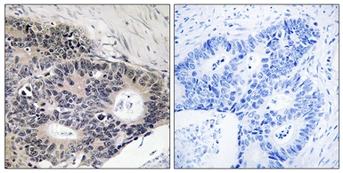 Anti-ABHD12B antibody used in IHC (Paraffin sections) (IHC-P). GTX87709