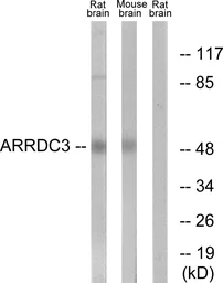 Anti-ARRDC3 antibody used in Western Blot (WB). GTX87776