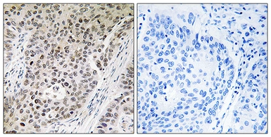 Anti-ZNF608 antibody used in IHC (Paraffin sections) (IHC-P). GTX87788