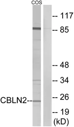 Anti-CBLN2 antibody used in Western Blot (WB). GTX87797
