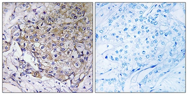 Anti-WASF3 antibody used in IHC (Paraffin sections) (IHC-P). GTX87825