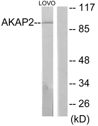 Anti-AKAP2 antibody used in Western Blot (WB). GTX87891