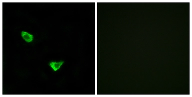 Anti-CHSY2 antibody used in Immunocytochemistry/ Immunofluorescence (ICC/IF). GTX87921