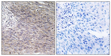Anti-CHSY2 antibody used in IHC (Paraffin sections) (IHC-P). GTX87921