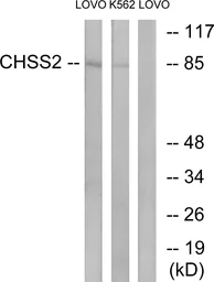 Anti-CHSY2 antibody used in Western Blot (WB). GTX87921
