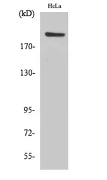 Anti-PHF3 antibody used in Western Blot (WB). GTX87923
