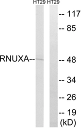 Anti-PHAX antibody used in Western Blot (WB). GTX87958