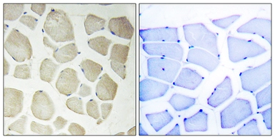 Anti-NKIAMRE antibody used in IHC (Paraffin sections) (IHC-P). GTX87990