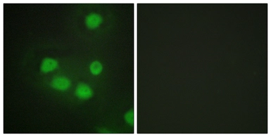 Anti-SIX6 antibody used in Immunocytochemistry/ Immunofluorescence (ICC/IF). GTX87996