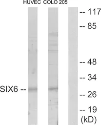 Anti-SIX6 antibody used in Western Blot (WB). GTX87996
