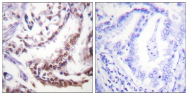 Anti-Histone H3K9ac (Acetyl Lys9) antibody used in IHC (Paraffin sections) (IHC-P). GTX88007