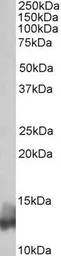 Anti-Phospholamban antibody, N-term used in Western Blot (WB). GTX88052