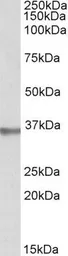 Anti-SPON2 antibody, Internal used in Western Blot (WB). GTX88064