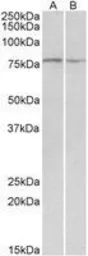 Anti-DAG1 antibody, Internal used in Western Blot (WB). GTX88089