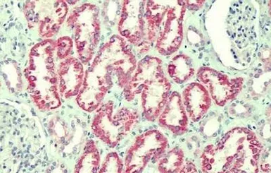 Anti-ANTXR2 antibody, Internal used in IHC (Paraffin sections) (IHC-P). GTX88121