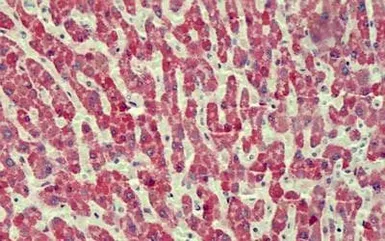 Anti-ANTXR2 antibody, Internal used in IHC (Paraffin sections) (IHC-P). GTX88121