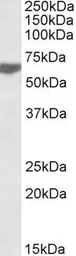 Anti-RAP1 antibody, C-term used in Western Blot (WB). GTX88131