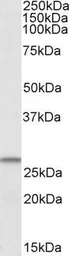 Anti-CHCHD3 antibody, Internal used in Western Blot (WB). GTX88139