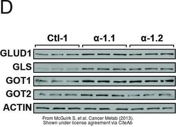 Anti-GLUD1 + GLUD2 antibody, Internal used in Western Blot (WB). GTX88164