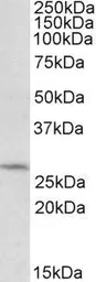 Anti-DCUN1D1 antibody, C-term used in Western Blot (WB). GTX88168