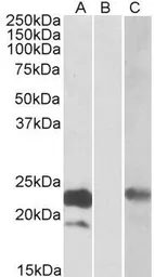 Anti-Cystatin 8 (aa 23-34) antibody, Internal used in Western Blot (WB). GTX88202