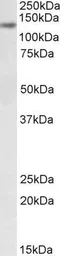 Anti-DIAPH1 antibody, Internal used in Western Blot (WB). GTX88212