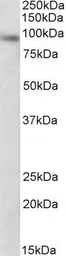 Anti-DTX3 antibody, Internal (near N-term) used in Western Blot (WB). GTX88228