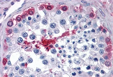Anti-GPI antibody, Internal (near N-term) used in IHC (Paraffin sections) (IHC-P). GTX88240