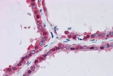 Anti-GPI antibody, Internal (near N-term) used in IHC (Paraffin sections) (IHC-P). GTX88240