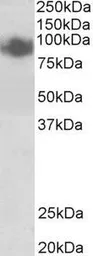 Anti-Blimp1 antibody, Internal used in Western Blot (WB). GTX88296